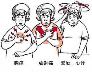 冠心病有哪些癥狀？(圖1)